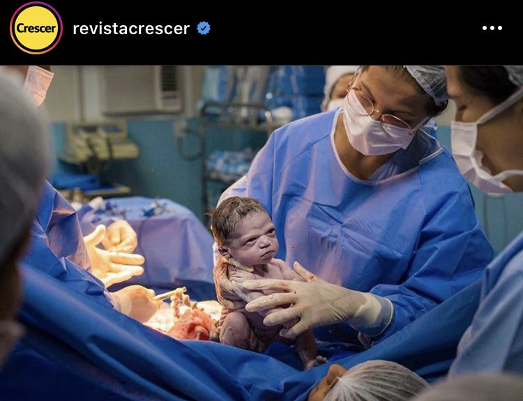 Bebê nasce "brava" e foto viraliza nas redes sociais
