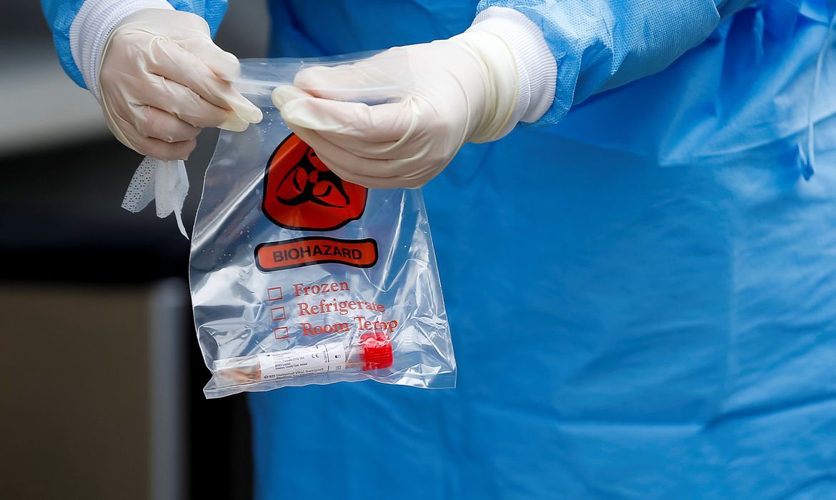 Estudo indica que maioria de infectados cria anticorpos