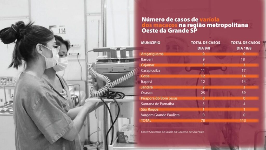 Varíola dos macacos: cidades da região registram 113 casos. Osasco lidera com 39 infectados