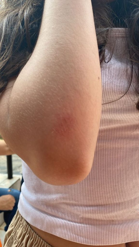 Eleições: candidata a vereadora Mari Tavelli é agredida em Barueri