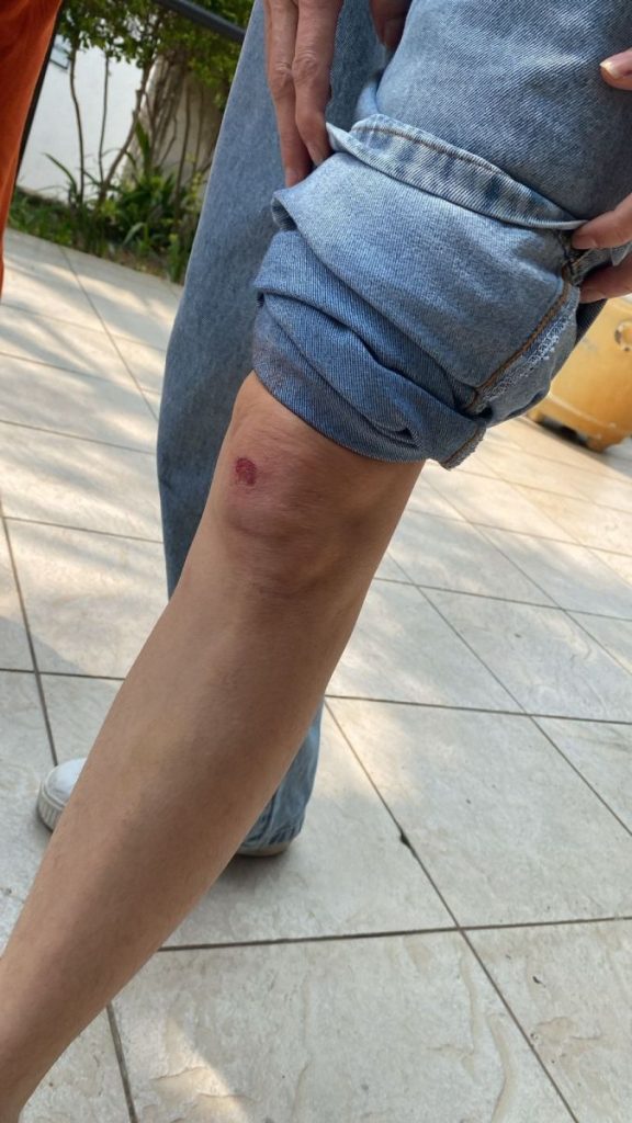 Eleições: candidata a vereadora Mari Tavelli é agredida em Barueri