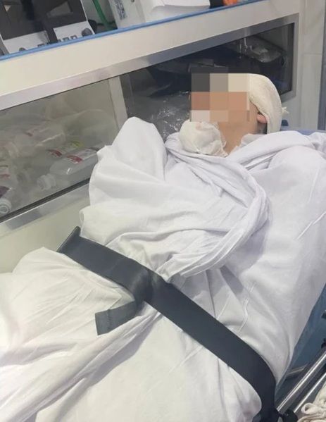 Barueri: jovem atropelado por MC Tuto segue em estado grave na UTI